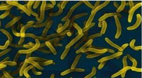 微生物菌劑好？好在哪里您知道嗎？